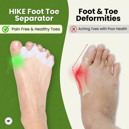 HIKE Foot Toe Separator - Gezonde tenen, correctie van bunions, hamertenen en verlichting van voetpijn